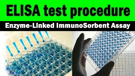 elisa test lab report|elisa test steps.